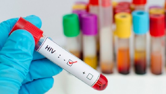 Zbulohet ilaçi kundër HIV nga shkencëtarët