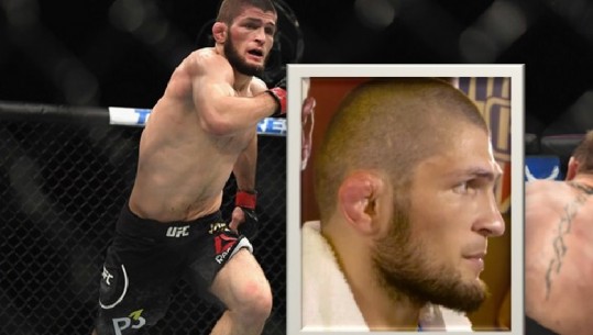 Detaji në veshin e Khabib Nurmagomedov, çfarë i kanoset kampionit të botës