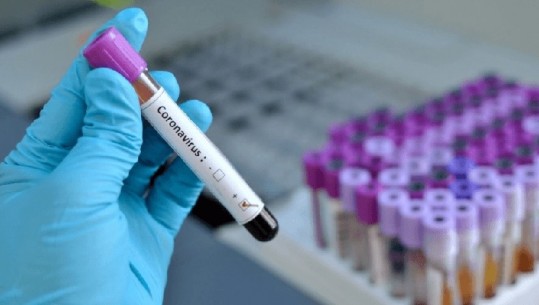 SHBA/ FDA miraton testin e parë për koronavirus që mund të bëhet vetë nga shtëpia