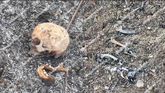 Kurbin, ndjejnë erën e rëndë, banorët gjejnë mes shkurreve eshtrat e një njeriu! Mjekësia ligjore merr mostrat, por lë një pjesë të tyre në vendin e ngjarjes (VIDEO)