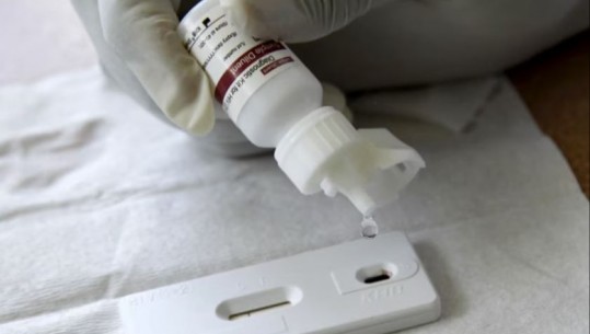 OBSH: Evropa duhet të vazhdojë luftën kundër HIV/AIDS-it