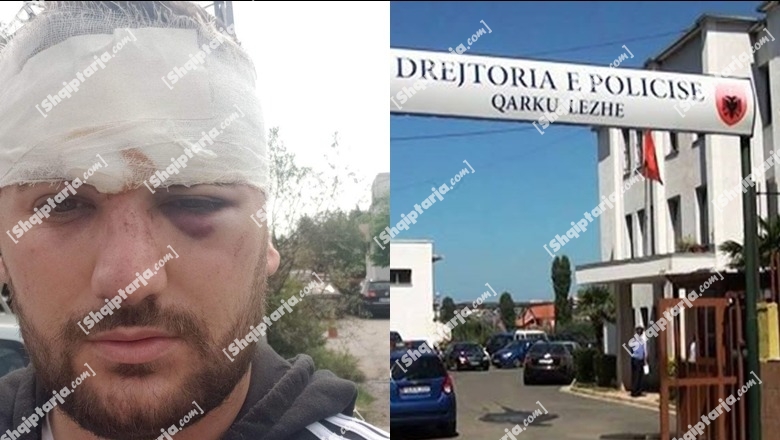 Sherr për shitjen e qirinjve në Kishën e Laçit, rojet private përplasen me tregtarët ambulantë! Përgjegjësi i sigurisë: Te ndërhyje shteti, mund të shkohet në vetëgjyqësi